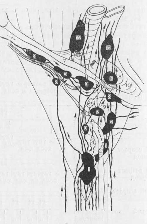 Схематическое изображение расположения паховых лимфатических узлов