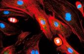 Искусственные клетки стимулируют противораковый иммунитет