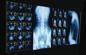 Рентгеновская компьютерная томография мочевого пузыря