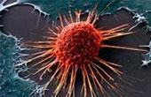 Атипичная гиперплазия ассоциирована с повышенным риском риском рака эндометрия