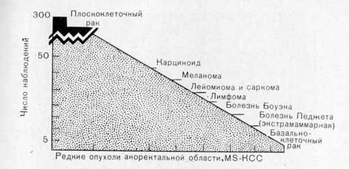 Редкие опухоли аноректальной области