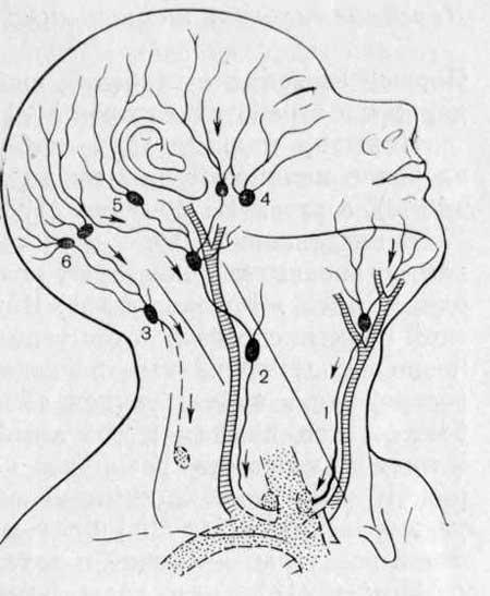 Схематическое изображение лимфопроводящих путей шеи