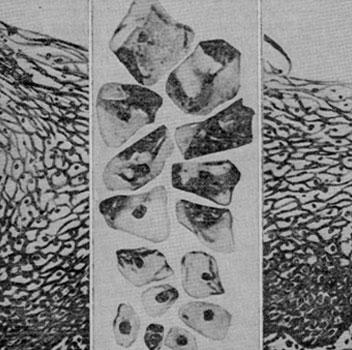Вагинальный эпителий в период пролиферативной фазы менструального цикла (по О. Nyklicek, 1970)