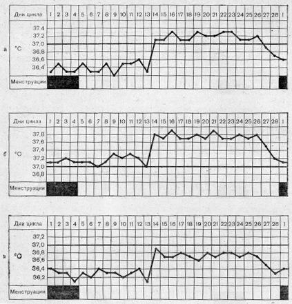 Кривые базальной температуры при нарушениях экскреции прогестерона