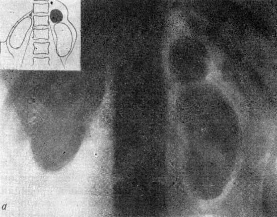 Рентгенологическая диагностика