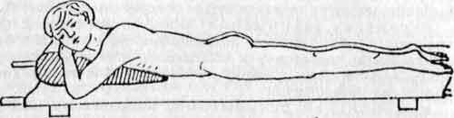 Укладка пострадавшего при травме спины