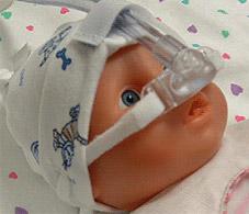NeoPAP™ — система CPAP для новорожденных