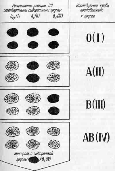 Определение групп крови АВ0 по стандартным сывороткам (отмывка эритроцитов)