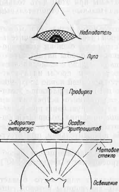 Схема учета результатов определения резус-фактора в солевой среде