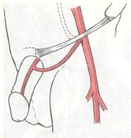 Схема реваскуляризации артерий полового члена