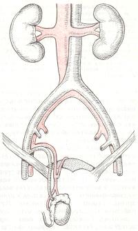 Схема пересадки яичка с расположением трансплантата в мошонке