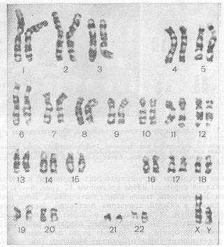 Кариотип здорового мужчины