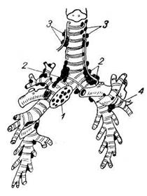 Схема лимфатических узлов легких (По Сукенникову)