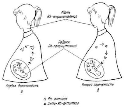 Схема механизма взаимодействия резус-отрицательной