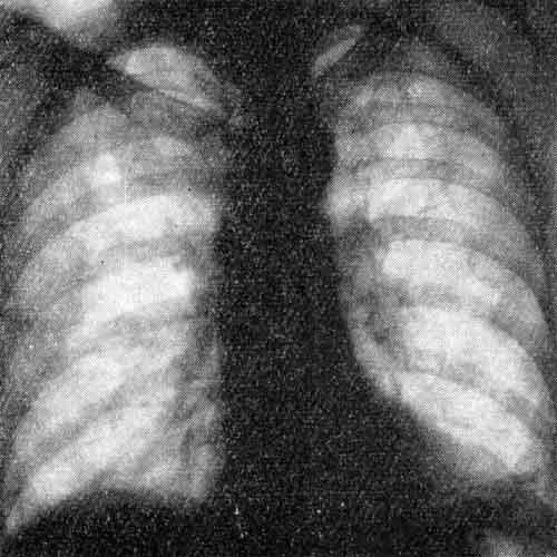 Органы дыхания (клинические признаки изменений)