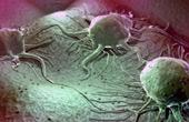 Открыт новый способ заставить раковые клетки «голодать»