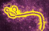 В Уганде зафиксирована вспышка лихорадки Эбола