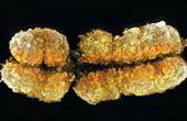 Ученые починили ломкую хромосому