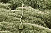 Ингибиторы  могут влиять на показатели анализа спермы