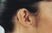 В России впервые имплантировано электронное среднее ухо
