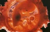 Аборт неблагоприятно отражается на детях, родившихся впоследствии