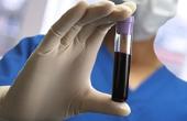 В России создадут единую базу доноров крови