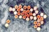 Условно патогенная бактерия вырабатывает лекарство от воспаления кишечника