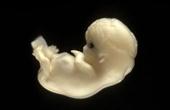 Бразильский суд разрешил эксперименты с клетками эмбрионов человека