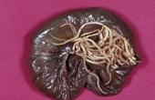 Паразитарные черви
