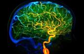 Роль эпигенома в развитии головного мозга человека
