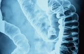 Виды контрастного рентгенологического исследования пищеварительного тракта