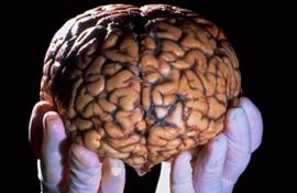 Человеческий мозг