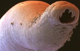 Голова анкилостомы (паразитического червя)
