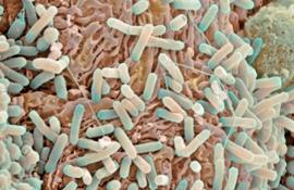 Бактерия E. coli