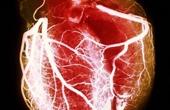 Диспансерное наблюдение больных с артериальной гипертензией