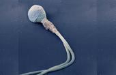 Деформированный сперматозоид