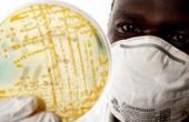Масштабы эпидемии холеры в Зимбабве растут