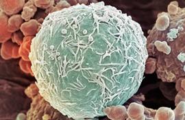Кровяная клетка лейкемии
