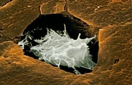 Костная клетка
