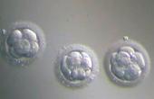 Японские врачи перепутали эмбрионы