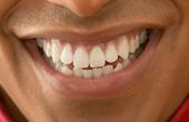 Американские ученые описали ген, контролирующий образование зубной эмали
