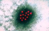2800 пациентов американского онколога подверглись риску заражения гепатитом B