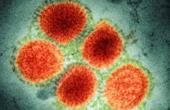 Российские ученые выделили штамм гриппа H1N1