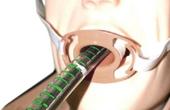Врачи испытывают методику хирургического уменьшения желудка через рот