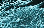 Обнаружены потенциальные пути борьбы с лихорадкой Эбола