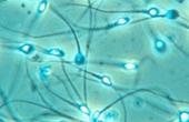 Авторов статьи о получении сперматозоидов из стволовых клеток уличили в плагиате