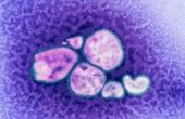 Европейское региональное бюро ВОЗ зарегистрировало случай смерти российского гражданина от гриппа H1N1