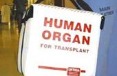 Российская трансплантология испытывает жесткий дефицит донорских органов