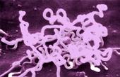 Уровень заболеваемости сифилисом в Шотландии бьет все рекорды