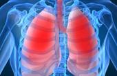 Разработана технология диагностики рака легких по запаху